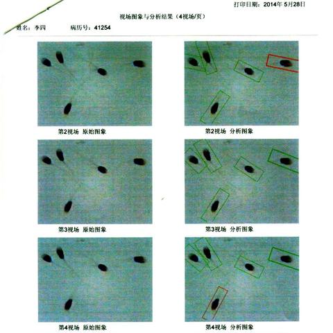 H酸价钱走势最新剖析